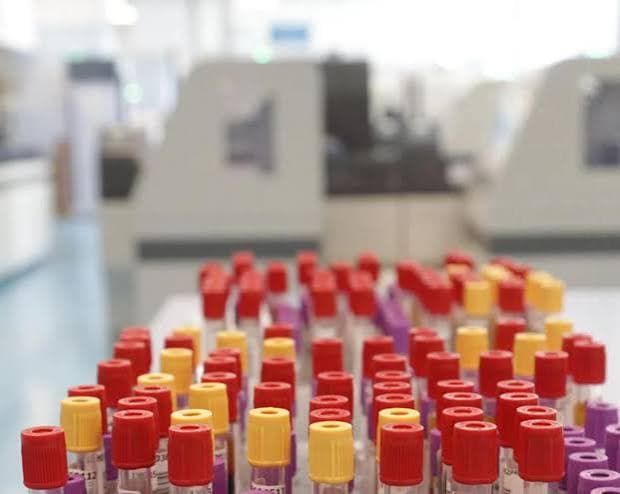 Otto casi di malaria a Francoforte: tre vittime nell'area aeroportuale